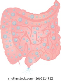 Bloating and excess gas in  intestine vector illustration isolated on a white background