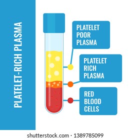 Blood After Separation Of Platelets In The Centrifuge. PRP Infographics With A Test Tube. Platelet-rich Plasma Laboratory Equipment. Regenerative Medicine Concept. Vector Illustration.