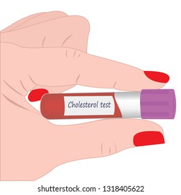 Blood cholesterol level laboratory test vector illustration