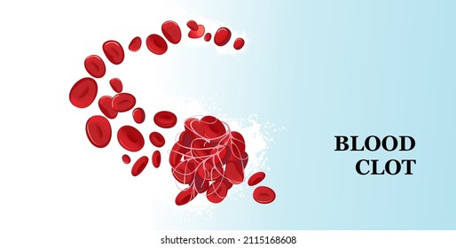 Blood Clot Made From Red Blood Cells Linked By Fibrin Filaments. Vector Illustration On White Background.