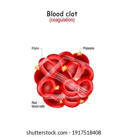 Blood Clot Structure. Coagulation, And Clotting. Hemostasis. Thrombus