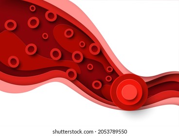 Blood Clot, Thrombus In Vein Or Artery, Vector Illustration In Paper Art Style. Arterial Clot Or Deep Vein Thrombosis. Medical Poster Template.