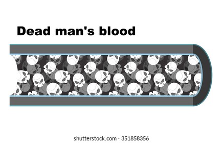 Blood of dead man. cells in form of skulls. Anatomy vessel. Vienna corpse. White lifeblood cell death