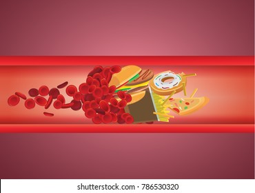 
Blood Flow Blocked From Fast Food Which Have High Fat And Cholesterol. Illustration About Unhealthy Eating.