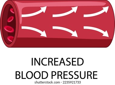 Blood flow with increased blood pressure text illustration