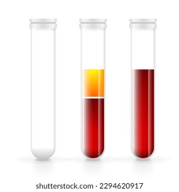 Sangre en frascos de vidrio, transfusión y análisis. Tubo de recolección de aspiradores y laboratorio. Iconos médicos con sangre y plasma. Ilustración vectorial.