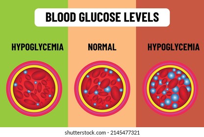 Blood Glucose Levels. Hunger Satiety, Sugar Level