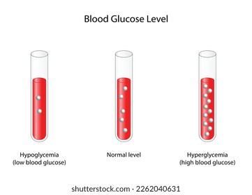 Niveles de glucosa en sangre. Nivel normal, hipoglucemia (bajo nivel de azúcar en sangre), hiperglucemia (alto nivel de azúcar en sangre), análisis de azúcar. Tubos de ensayo. diagrama de vector