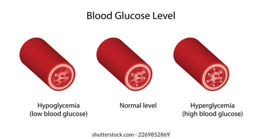 Blood Glucose Levels. Normal level, hypoglycemia (low blood sugar), hyperglycemia (high blood sugar), sugar test. vector diagram