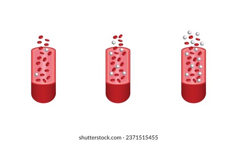 Blood Glucose Levels. Normal level, hypoglycemia (low blood sugar), hyperglycemia (high blood sugar), sugar test. vector diagram