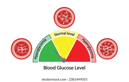Blood Glucose Levels. Normal level, hypoglycemia (low blood sugar), hyperglycemia (high blood sugar), sugar test. vector diagram