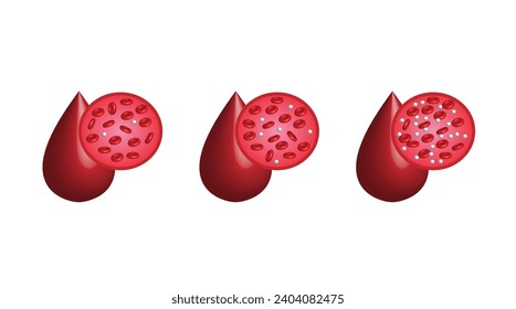Blood Glucose Levels. Normal level, hypoglycemia (low blood sugar), hyperglycemia (high blood sugar), sugar test. vector diagram