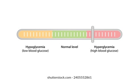 Niveles de glucosa en sangre. Nivel normal, hipoglucemia (bajo nivel de azúcar en sangre), hiperglucemia (alto nivel de azúcar en sangre), análisis de azúcar. diagrama de vector