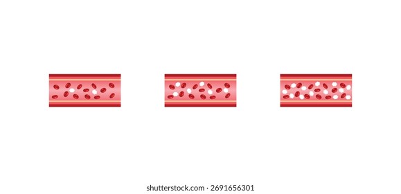 Níveis De Glicose No Sangue. nível normal, hipoglicemia (nível baixo de açúcar no sangue), hiperglicemia (nível elevado de açúcar no sangue), teste de açúcar. Ilustração de vetor.
