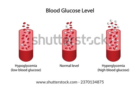 Blood Glucose Levels. Normal level, hypoglycemia (low blood sugar), hyperglycemia (high blood sugar), sugar test. vector diagram
