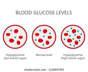 3,322 Hypoglycemia Stock Vectors, Images & Vector Art | Shutterstock