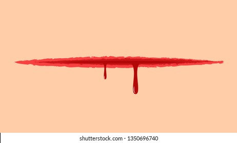Blood or lesion vector.