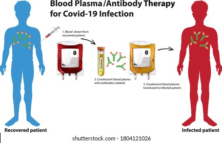 Blood Plasma/Antibody Therapy For Covid-19 Infection Infographic Illustration