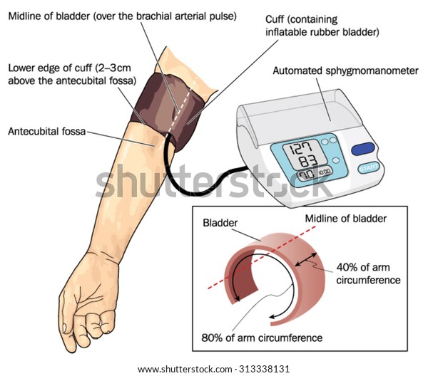 Collection 92+ Pictures where to place bp cuff on arm Full HD, 2k, 4k