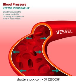 Blood Pressure Infographic