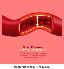 Blood Pressure Infographic