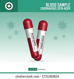 Blood sample concept : COVID-19 UPDATE text with blood sample vacuum tube on green background. Covid-19 or Coronavirus Concept