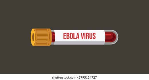 Blood sample in test tube labeled 