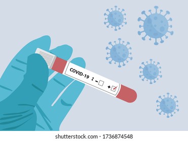 Blutprobenteströhre, positive Coronavirus-Test-Vektorbild