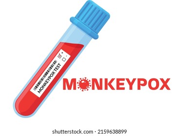 Blood sample tube for Monkeypox virus test. It is also known as the Monkeypox virus. blood tube for the Monkeypox virus test 