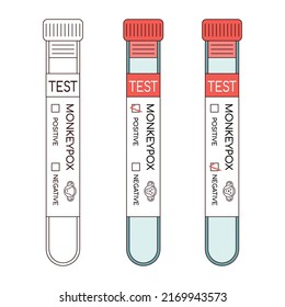 Tubo de muestra de sangre para la prueba del virus Monkeypox.