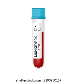 Blood sample tube with Monkeypox virus test isolated on white background. Vector realistic illustration. Design for medical banner, flyer, card, infographic