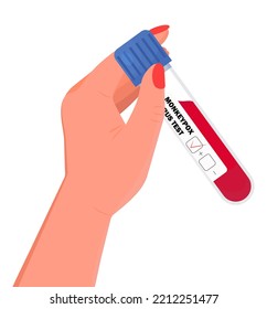 Tubo de muestra de sangre para el vector de prueba del virus Monkeypox. Ensayo, tubo de laboratorio con sangre humana. Control de pruebas para el virus Monkeypox.