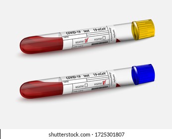 Blood sample in in two glass test tubes. Covid-19 test. Positive and negative results SARS-CoV-2. Isolated on white. Coronavirus analysis. Blood test. Vector illustration.