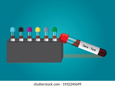 Blood sample for Urea test. Diagnosis of kidney or renal disease. A medical testing concept with tube vector in the laboratory background.