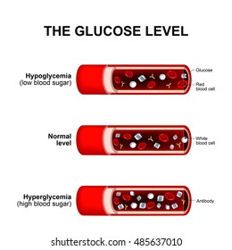 blood sugar level or glucose level. Normal level, Hyperglycemia and Hypoglycemia. blood vessels with crystals of sugar (glucose ), white and red blood cells