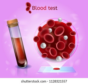 Blood Test Realistic Vector Concept with Venous or Arterial Blood in Lab Glass Tube, Magnified Blood Drop with Erythrocytes and Leukocyte Cells on Glass Slide Illustration. Medical Laboratory Research