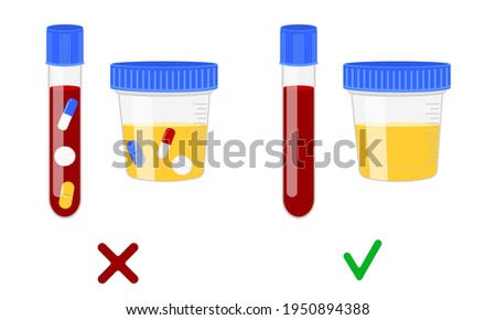 Blood and urine samples with and without different drugs. Doping control in sport, post accident drug testing concept. Vector cartoon illustration.