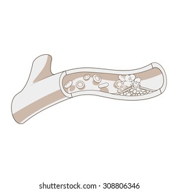 Blood vessel and clot thrombus vector illustration