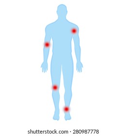 blue human silhouette on a white background. joint pain, joint diseases, joint infection, pain on movement, inflammation in the joints.Modern Medical vector infographics. Medic anatomy