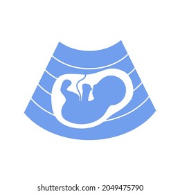 blue icon ultrasound of fetus. concept of baby in womb mother, pregnancy and health, examination procedure of embryo, placenta and umbilical cord. emblem for gestational center. simple sign on white