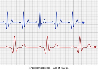 Blue and red heartbeat diagram on grey graph paper for Cardio test line. Minimal Vector Design.