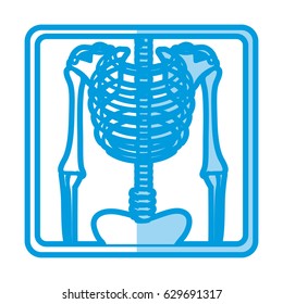 blue shading silhouette with x-ray of bones vector illustration