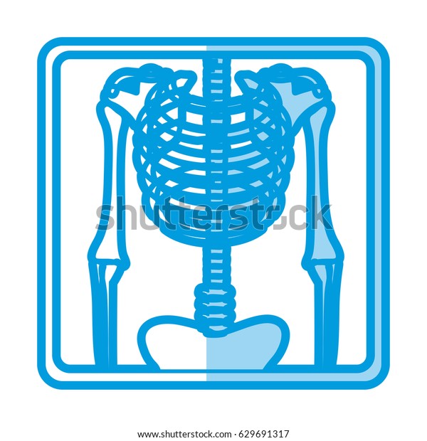 Blue Shading Silhouette Xray Bones Vector Stock Vector (Royalty Free ...