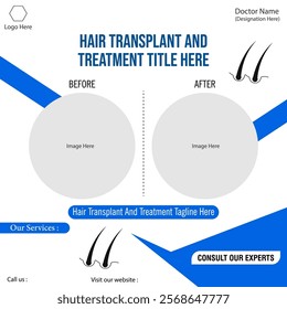 Blue and white creative abstract banner. Hair transplant and treatment advertisement vector graphics. Use for digital graphics.