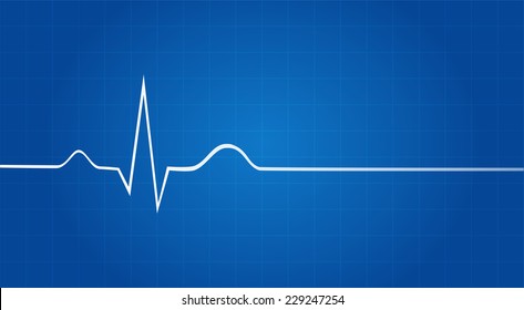 Blueprint Of Electrocardiogram Last Life Sign