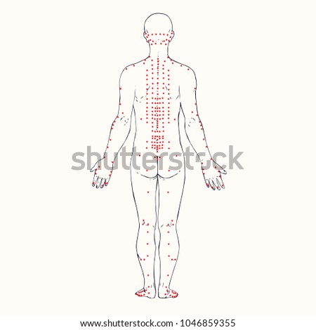 Body (back) acupuncture scheme with red points, hand drawn doodle, sketch in pop art style, black and white medical vector illustration