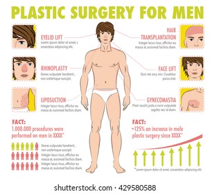 Body And Face Men Plastic Surgery: Infographics For Posters, Flyers, Brochures.Liposuction, Hair Transplantation, Gynecomastia, Eyelid Lift, Face Lift, Rhinoplasty.Male Body.Vector Elements And Icons.