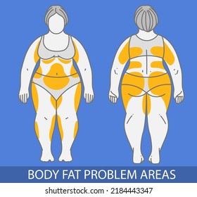 Body fat problem areas. Medical infographic. Healthcare illustration. Vector illustration. 