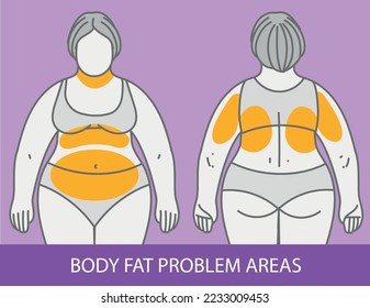 Body fat problem areas. Medical infographic. Healthcare illustration. Vector illustration.