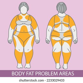 Body fat problem areas. Medical infographic. Healthcare illustration. Vector illustration. 